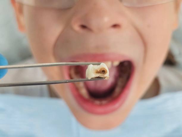 Best Pediatric Emergency Dentist in Bruceville Eddy, TX